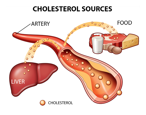 Belangrijke gezondheidsaspecten van cholesterol
